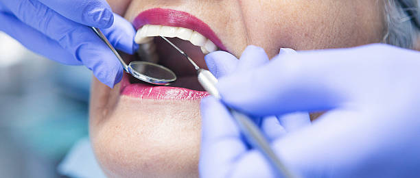 Best Emergency Root Canal Therapy in Caseyvle, IL